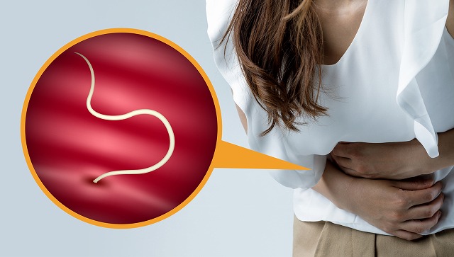 アニサキスとは